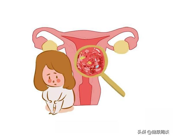 总是反反复复,阴道炎为什么难断根?妇科医生:原因无非这5个