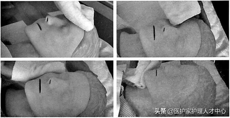 护理老人头发梳理与清洁,头部清理护理套餐