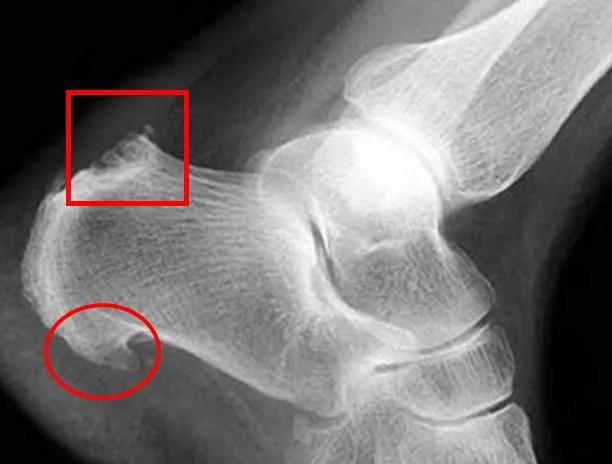 掌痛的最快解决办法,掌腕疼痛的治疗方法