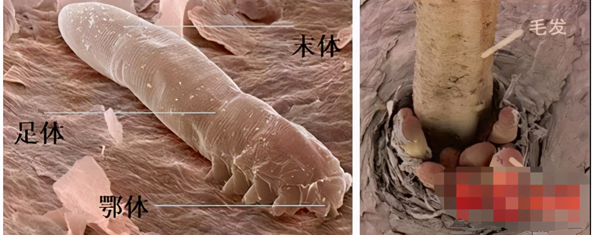 挑筋断骨切胃，那些为了美不要命的女人到底有多可怕