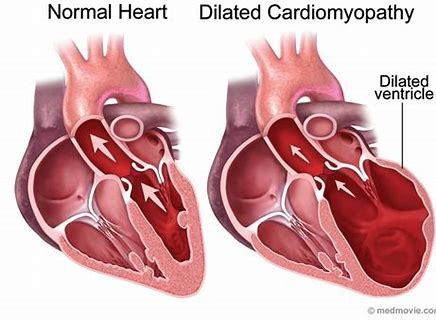 新发现：心脏不好多半是肝炎病毒惹的祸！该如何应对？