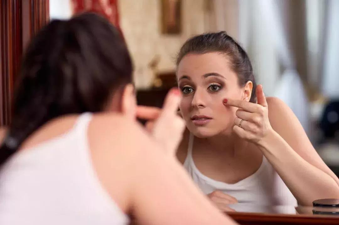 皮肤管理丨假期结束，和你一起上班的可能还有痘痘...