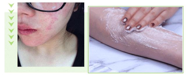 皮肤怎么变得白白嫩嫩干干净净,怎么让自己变得白白嫩嫩