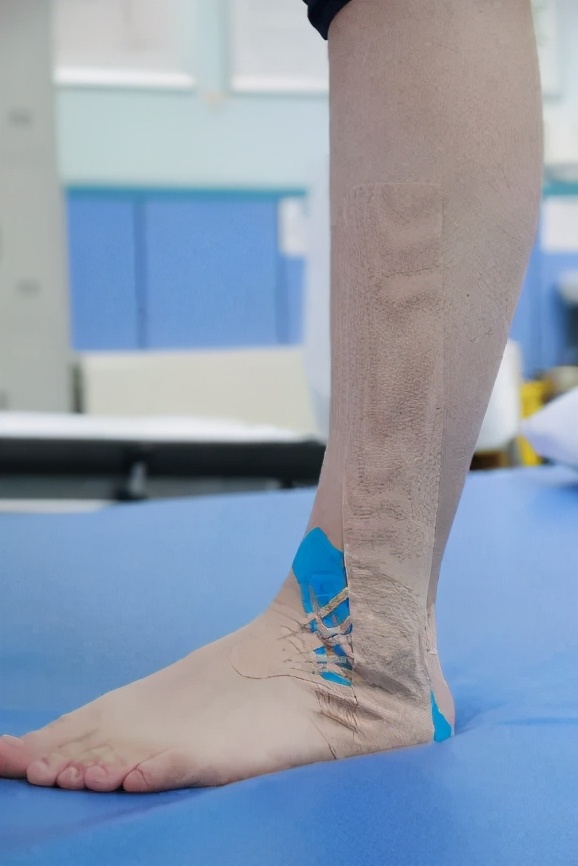 弹性贴布的原理,弹性贴布的作用