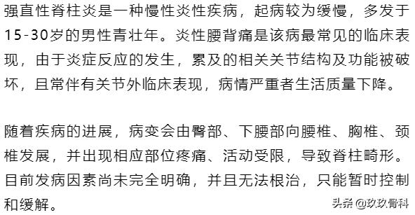 腰痛诊断及治疗,腰痛一招搞定半边腰痛是怎么了