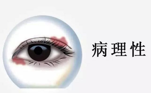 “左跳财右跳灾”有科学依据吗?专家带你揭秘经常眼皮跳动的原因