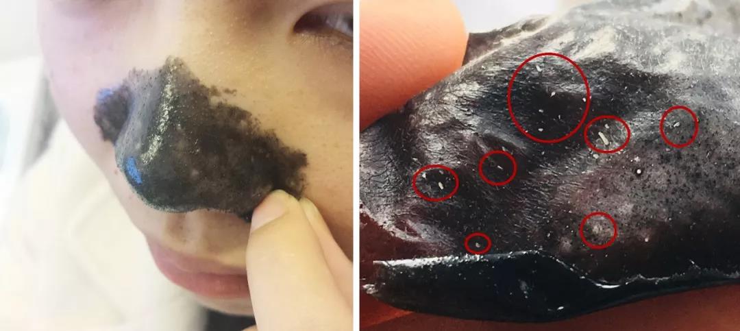 一秒去黑头去粉刺,一步就能搞定的黑头