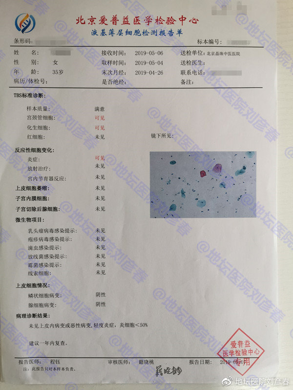 女，35岁，CIN2级，姑娘们，还以为宫颈癌离你们很远吗？