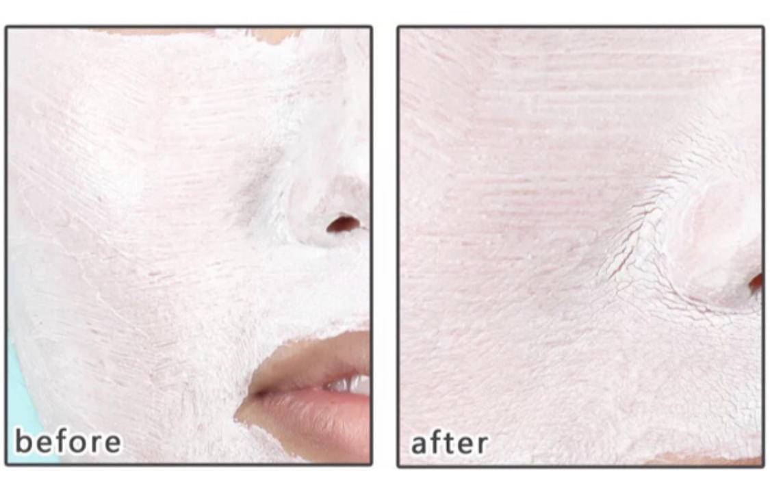 长时间没清理脸部,长期不正确的洗脸方式