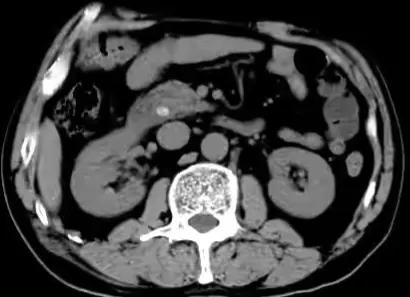 眼黄皮肤黄尿黄是怎么回事,发现皮肤变黑了怎么回事