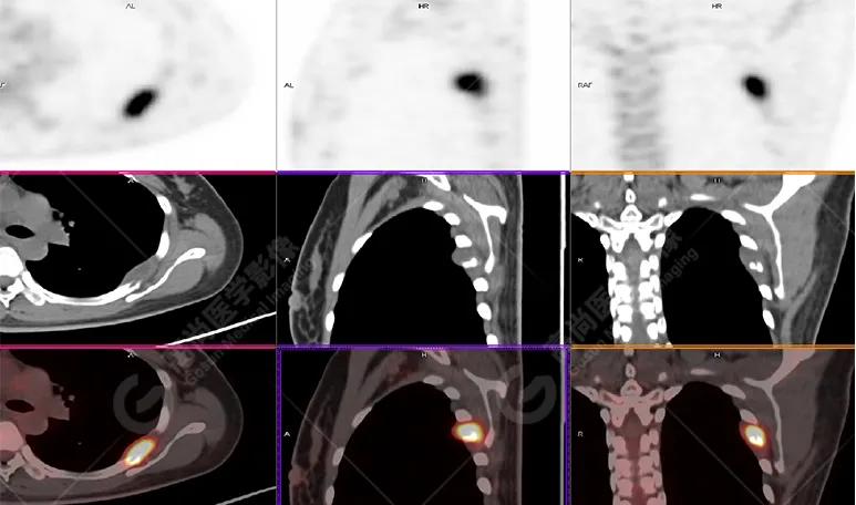 女性防癌检查科普,妇女宫颈癌及乳腺癌筛查情况年报