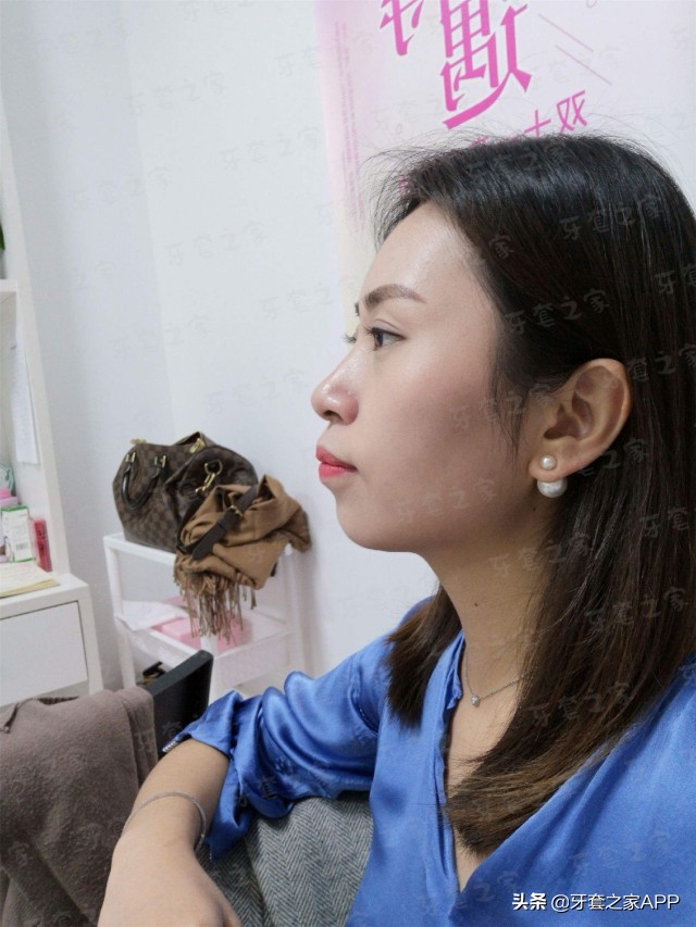 拔牙和打骨钉哪个更痛,矫正牙齿拔牙后一定要打骨钉吗