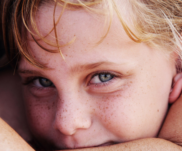 想淡斑先了解斑的种类,想祛斑用什么方法