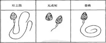 怀孕到底都检查什么,怀孕这个事容易么