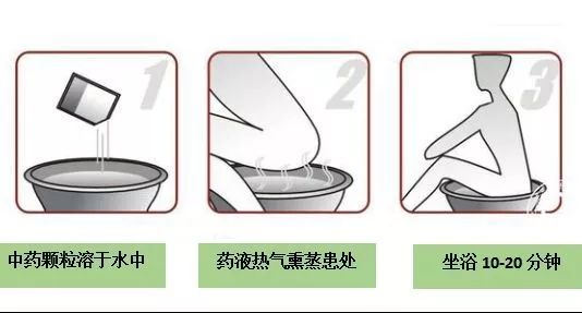 中医熏洗法操作视频,中医熏洗视频