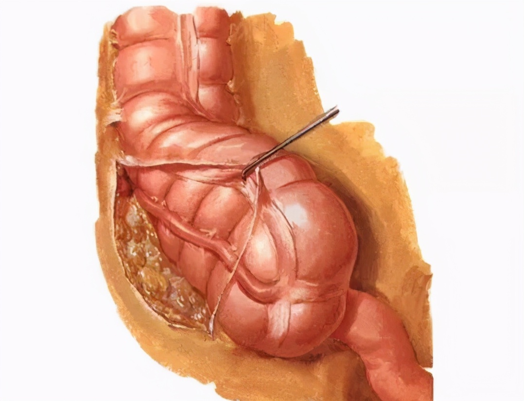 肛门狭窄的症状及治疗,肛门狭窄的症状及诊断标准