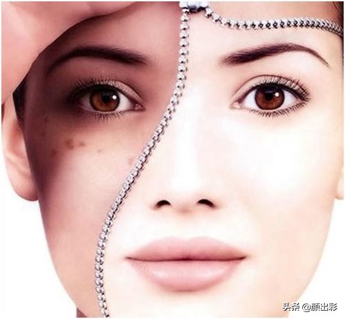 美白烟酰胺胶囊,烟酰胺美白祛斑