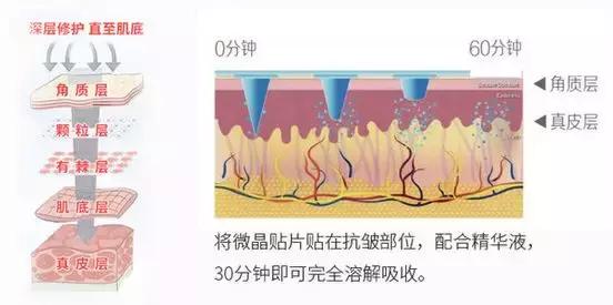 有了前法国第一夫人的百元“黑科技”眼霜，我把3000块眼霜扔了！