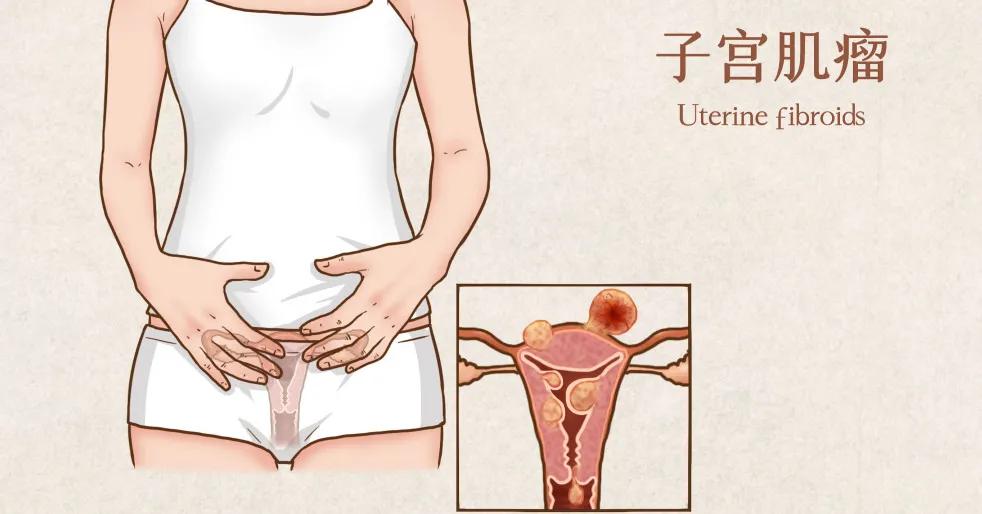 备孕最常见的七大误区,备孕容易陷入的8大误区