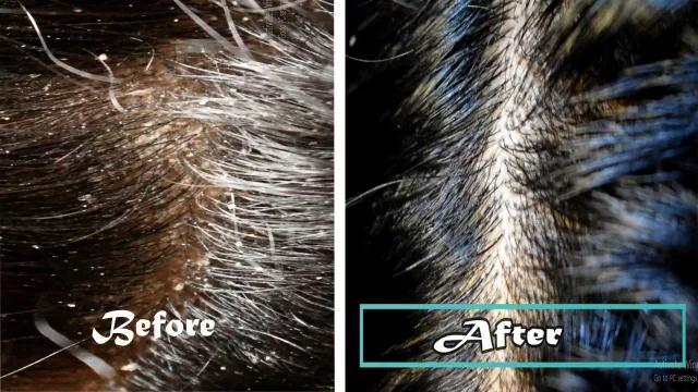 比海飞丝洗发水更好的国产洗发水,比海飞丝清扬好的洗发水