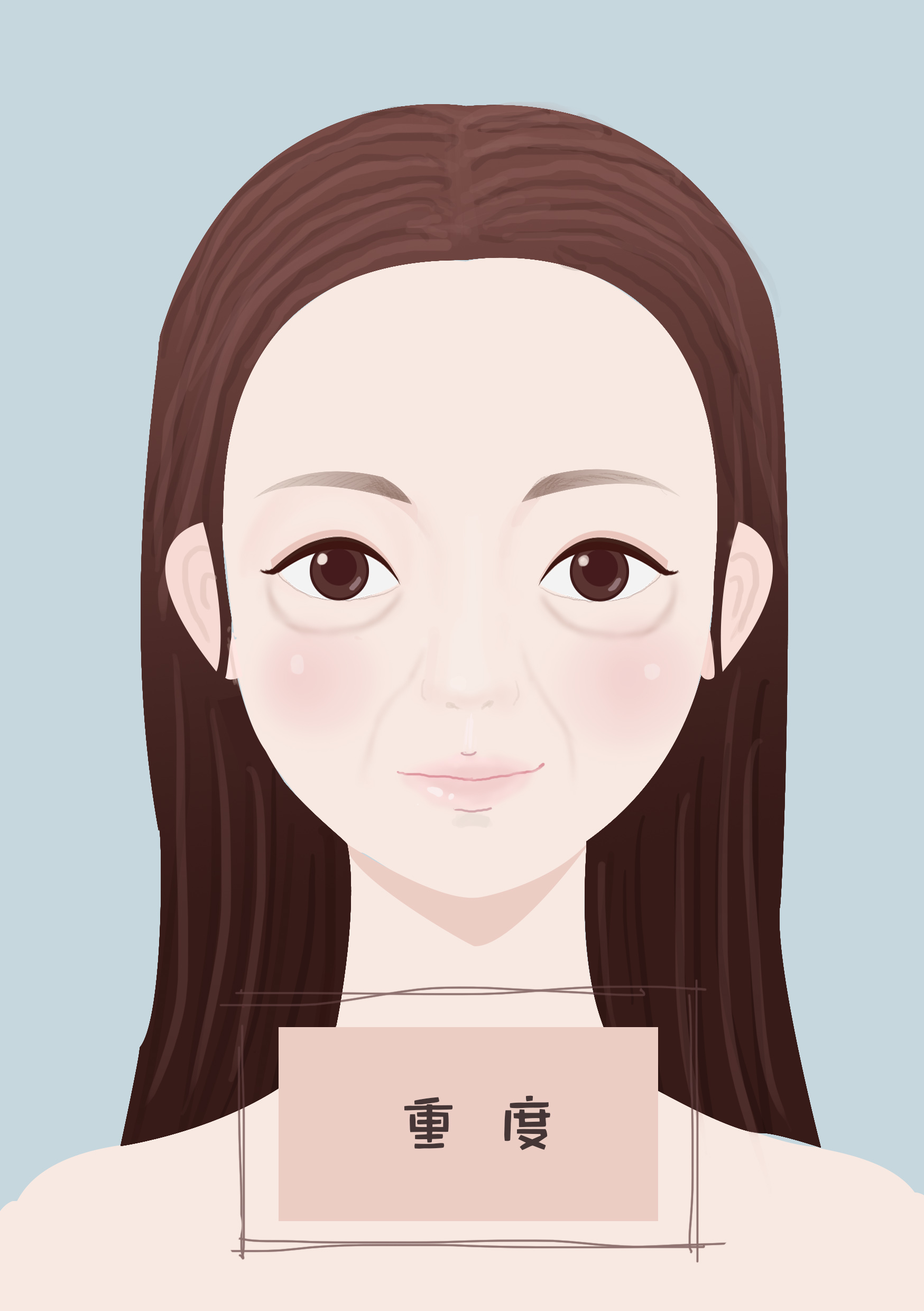 泪沟到底好不好,填了泪沟会不会很丑