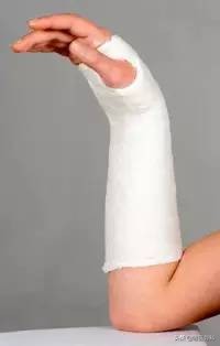 外固定多久恢复,外固定取出一般多久