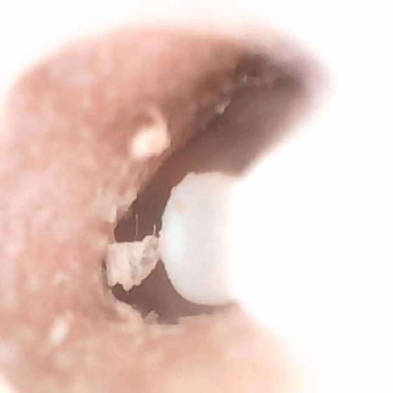 让你能看得见的掏耳朵“粑粑”,蜂鸟智能可视采耳棒M9Pro