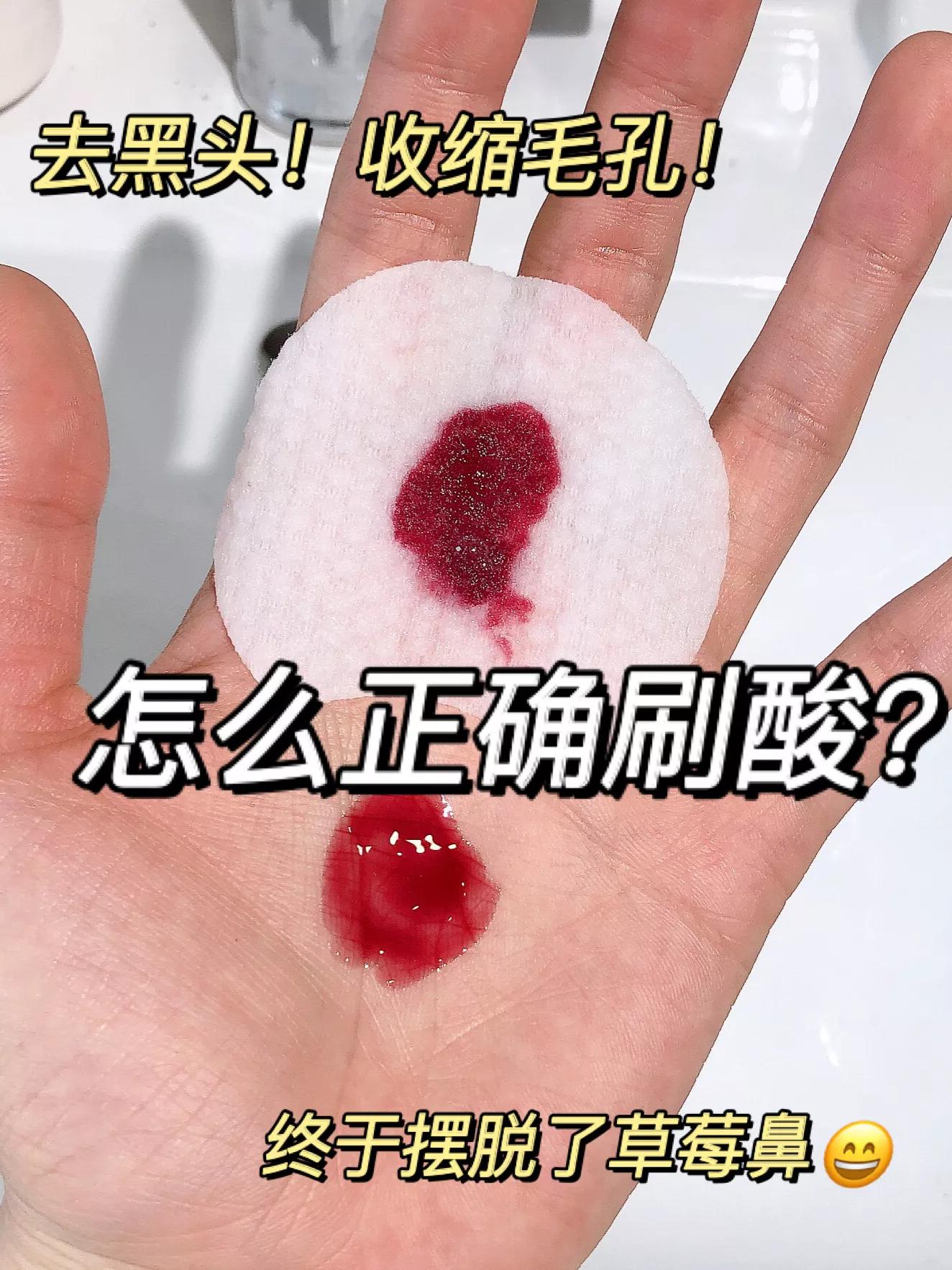 去黑头刷酸清洁过程,去黑头收缩毛孔维a酸和水杨酸