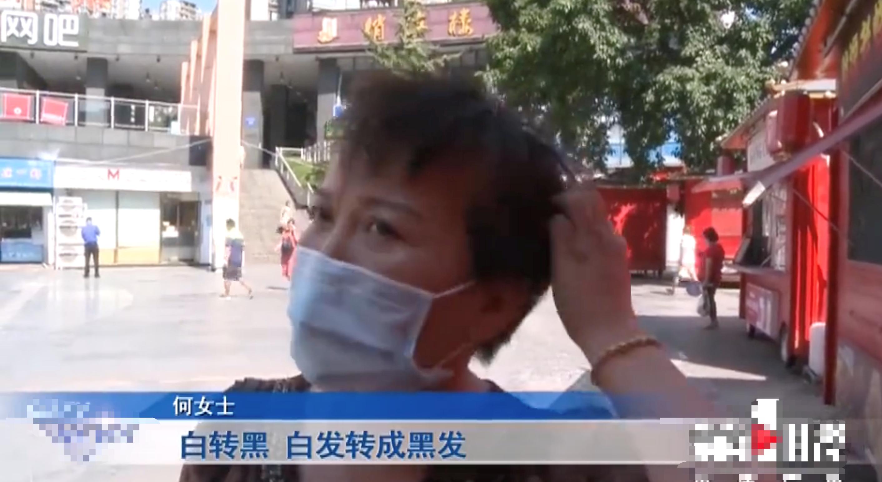 女子花4万治疗白发后续,女子花4万做白发转黑发后续
