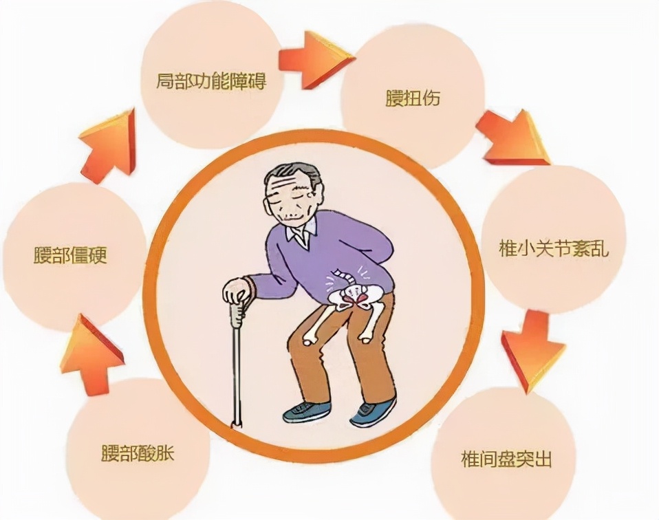 腰腿痛病因病机是什么,腰腿痛的病因全在这里了