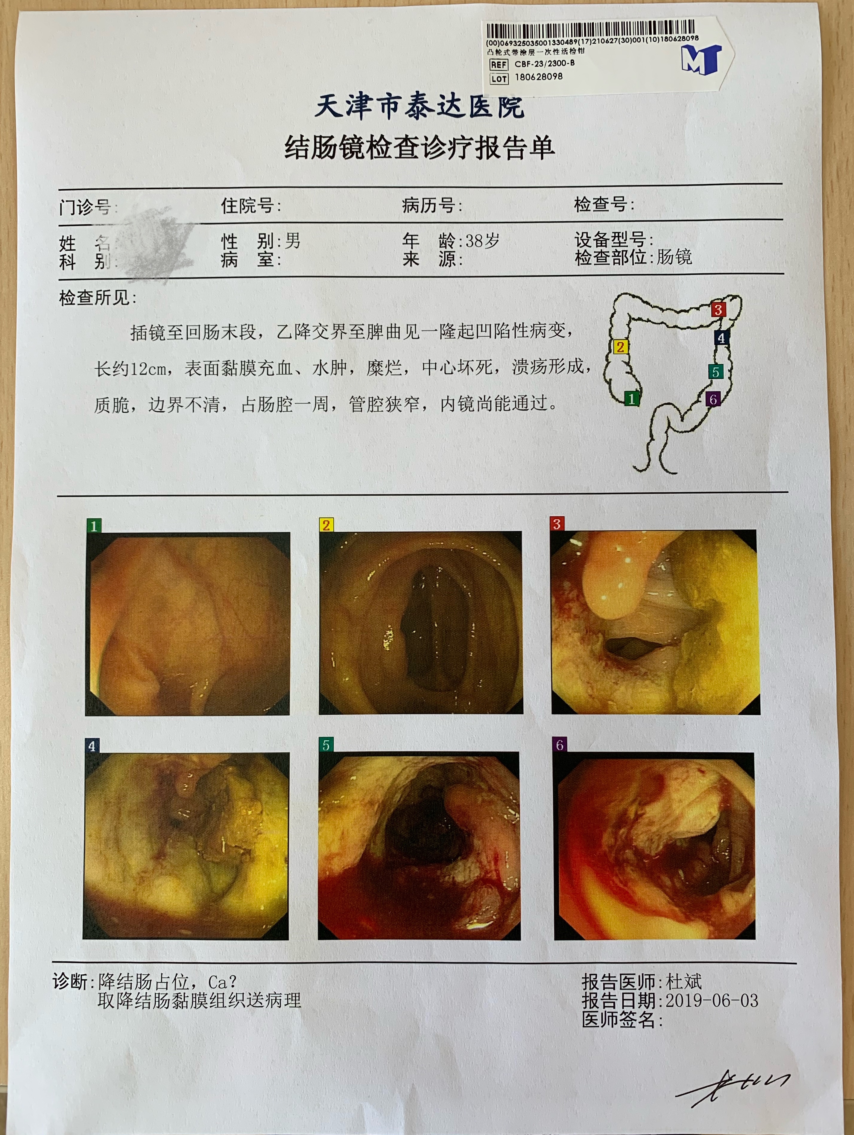 贫血患者的健康宣教,有点贫血要不要健康告知