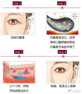 25岁脸部松弛下垂怎么紧致,25岁脸部松弛适合做什么项目