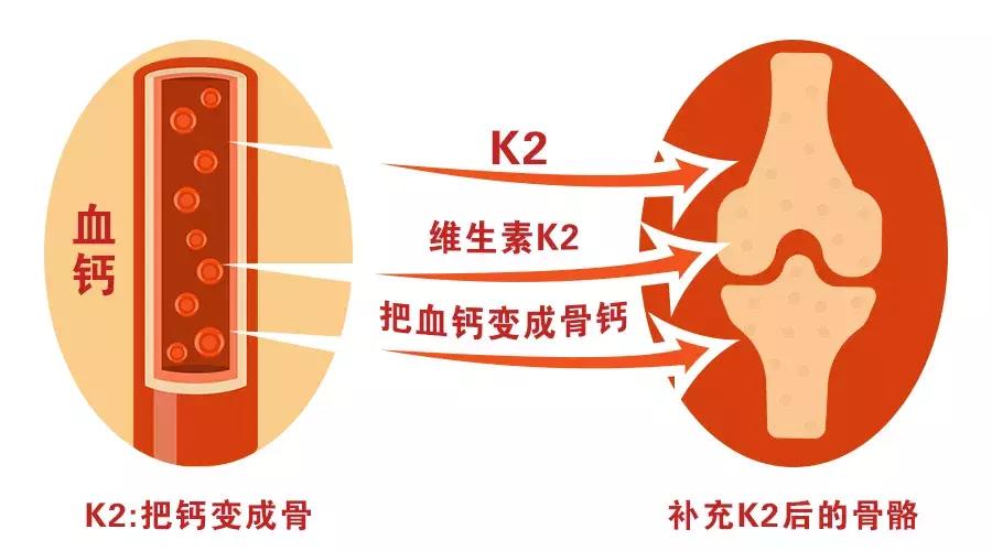 60岁的老人骨质疏松能补钙吗,动脉硬化骨质疏松吃什么