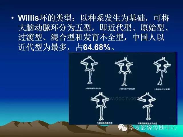 小脑血管解剖分段,脑血管影像解剖讲解