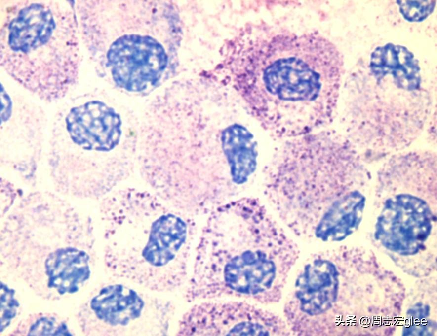 治疗蚊子咬后奇痒的药,跟蚊子咬的疙瘩一样奇痒无比