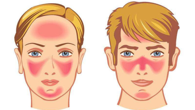 皮肤科医生经典小故事,皮肤科病例故事