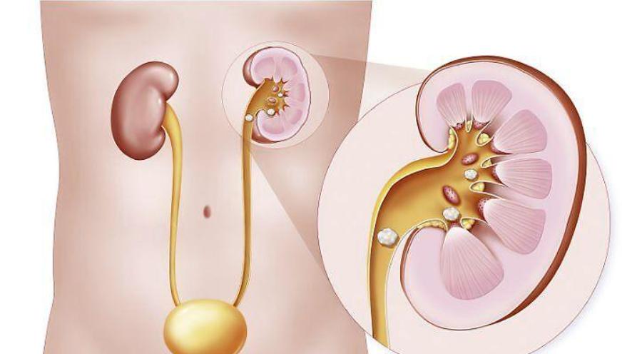 左腹部疼痛的可能病因做什么检查,左边腹部疼检查不出原因如何缓解