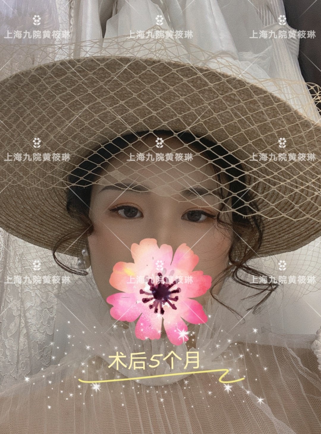 男生双眼皮跟女生有什么区别,男生双眼皮和女生双眼皮区别