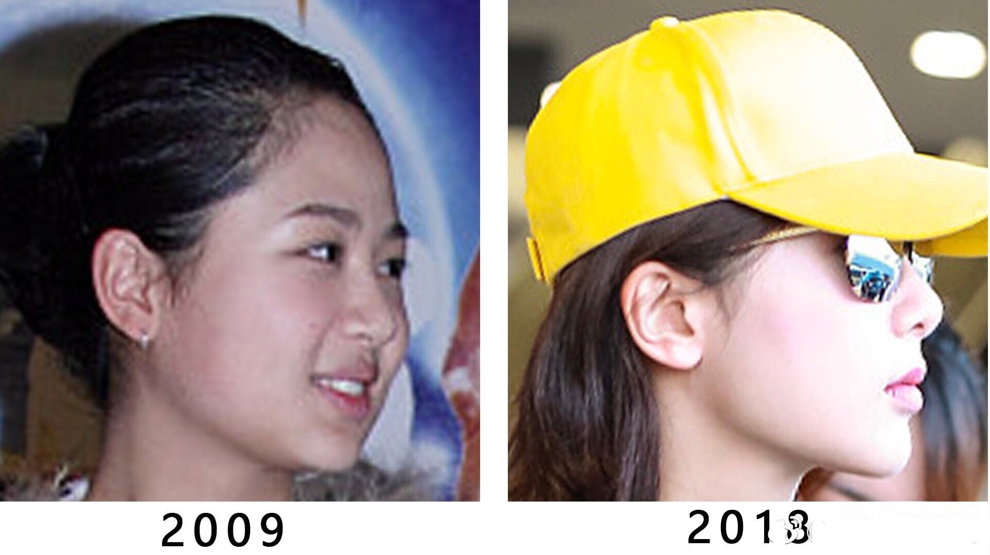 杨紫现身整形美容医院被嘲，牙齿矫形算不算整形？