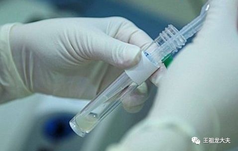 取精液之前需要注意什么？