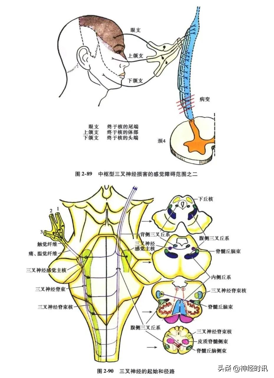 脑干解剖,脑干神经解剖