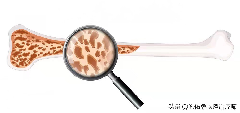 50岁更年期女性补钙的正确方法,50岁左右的女性出现各种疼痛