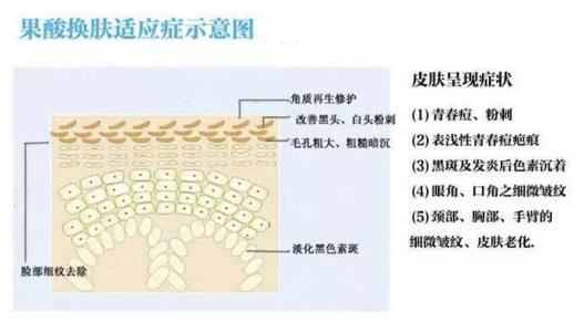 如果每天洗澡身体乳应该怎么擦,如果每天都护肤会怎么样
