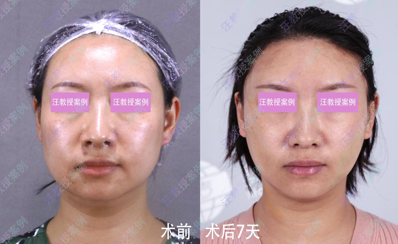 整形医生会给自己设计整形方案吗,整形医生也会整形吗