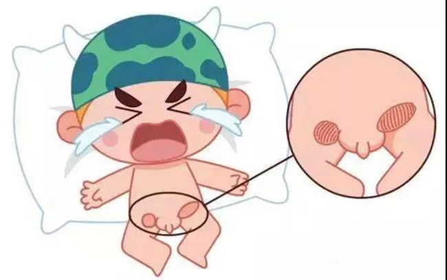 得了疝气不敢告诉家长怎么办,宝宝疝气会引起肚子胀吗