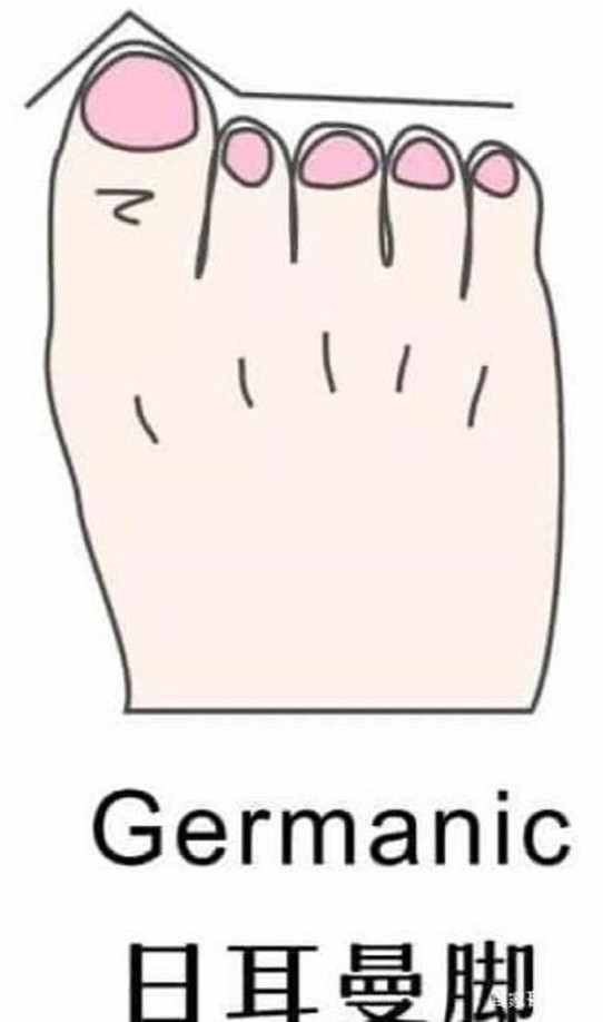 女性脚型有哪几种,女性脚型有哪些