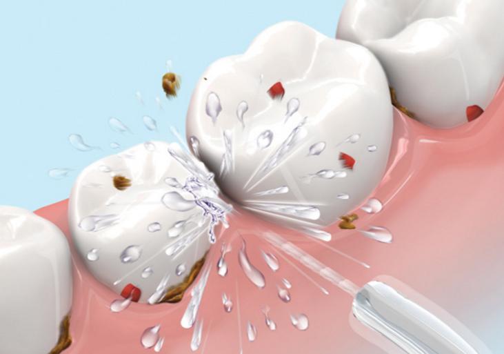 春季唇妆,唇妆不好看