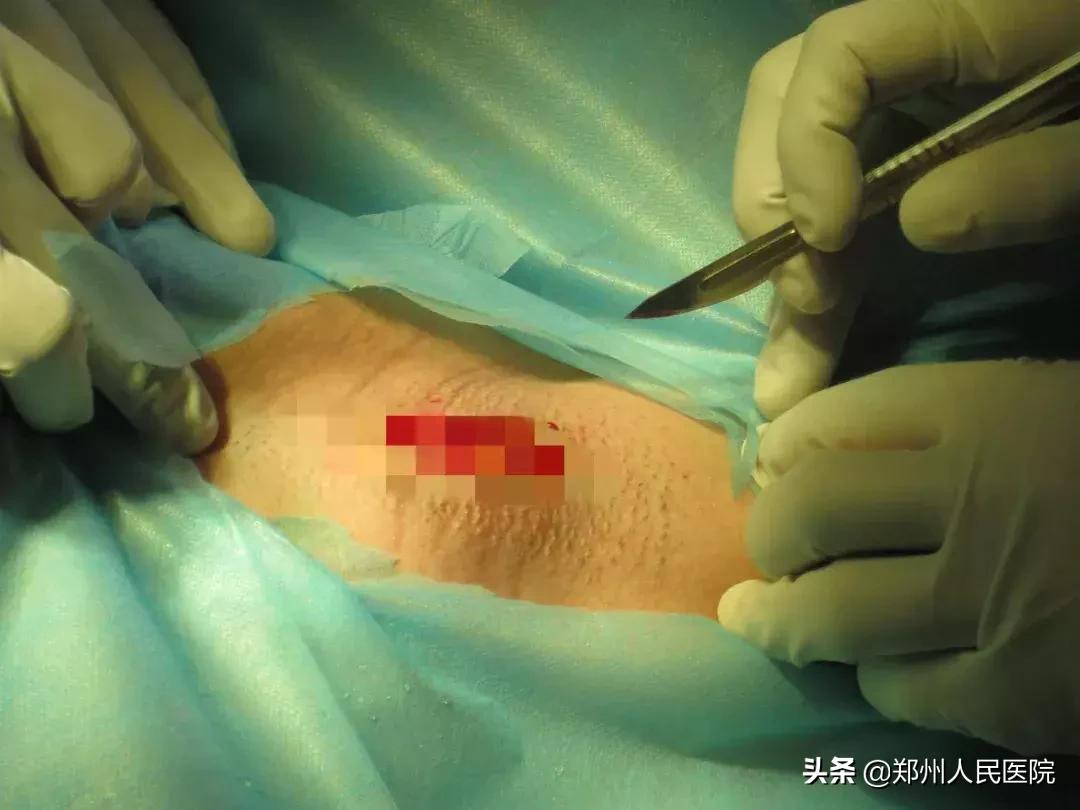 对味道敏感的人怎么办,对味道特别敏感的人真的很崩溃