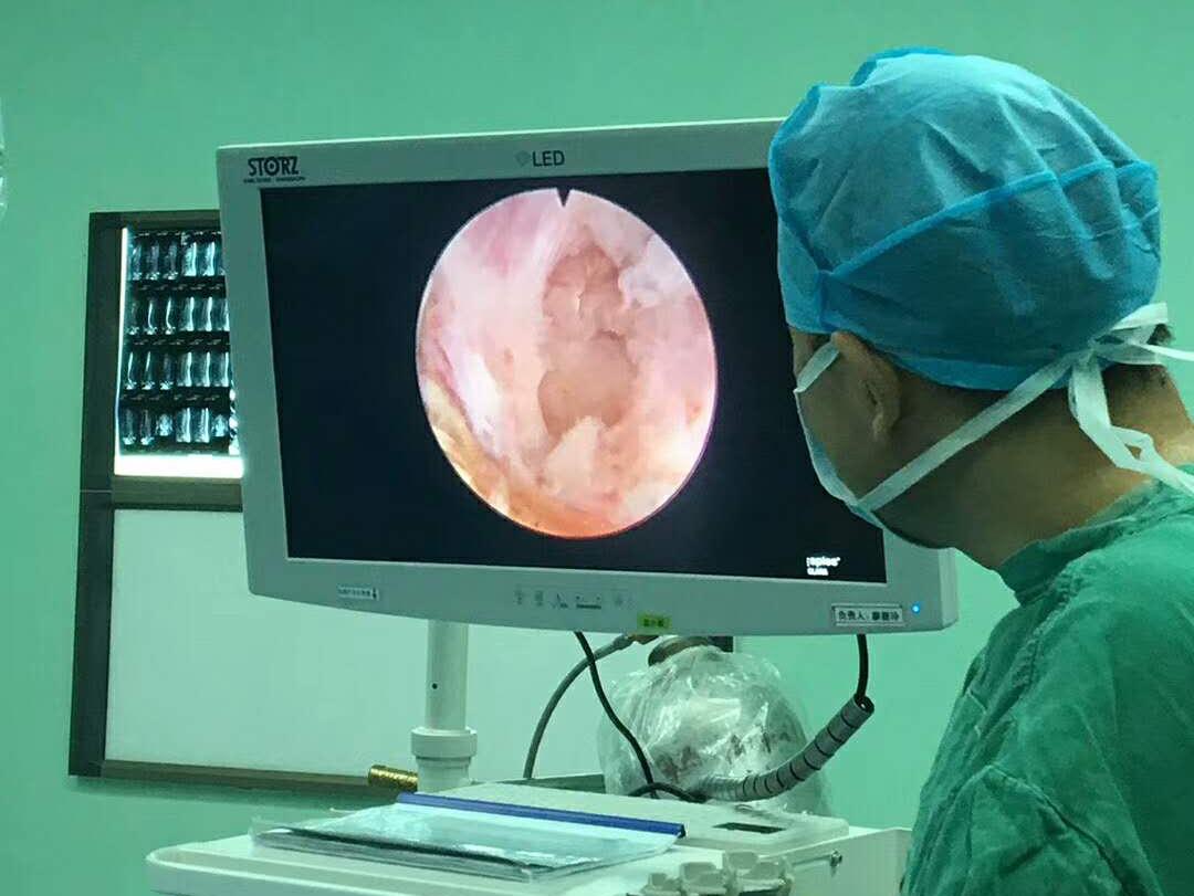 椎孔镜技术治疗颈椎间盘突出,椎间孔镜前沿技术