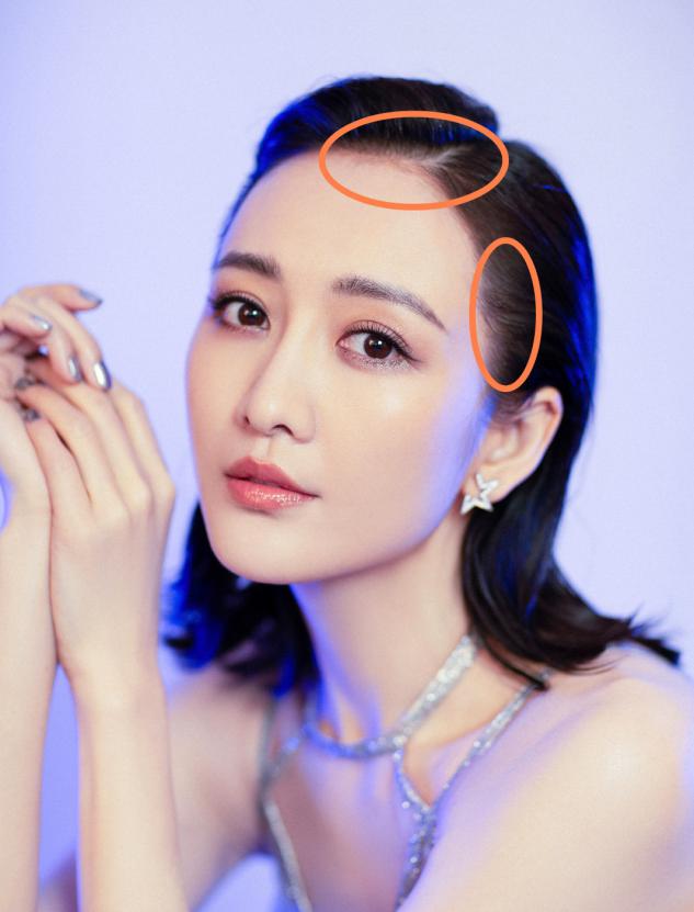 你的发际线怎么样,你的发际线有救了